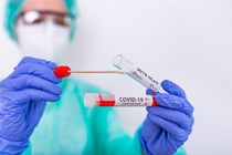 RT-PCR (Swab test) & Rapid test by PROLAB